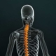 Human Skeleton with Spinal Cord Injuries Highlighted